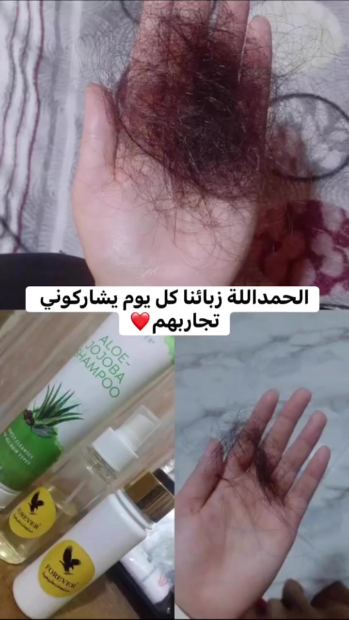 كورس التساقط الشعر 
موجود  الحابه تتطلب تتواصل خاص 
امن لرجال والنساء والاطفال


**إذا كنت صاحب هذا الإعلان وتريد حذفه لأي سبب، رجاءا أرسل رسالة إلى الدعم الفني**