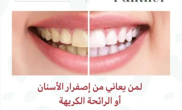 #اكسبلور_فولو_للبيج #لايكاتكم_وتعليقاتكم_تشجعنا_للاستمرار


**إذا كنت صاحب هذا الإعلان وتريد حذفه لأي سبب، رجاءا أرسل رسالة إلى الدعم الفني**