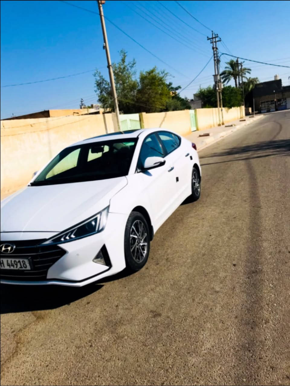 السلام عليكم النترا موديل 2019 السياره مكفوله كفاله عامه من الصبغ والبارد والتبديل اربع وضعيات قياده نورمال ايكو سبورت سمارت سياره بصمه فتحه والسعر 155 وبيه مجال كلش بصيط وجماعت ال 150تره مابيع الارقم ***********

