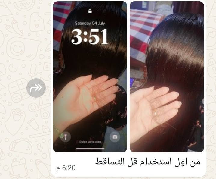 خلال ايام قليله يبين الفرق مع الالتزام بزيت الجوهرة
زيت الجوهرة الاصلي: تخلوا ع شعركم وانتم مأمنين مستحيل يضر شعركم بالعكس هو علاج ومسرح نفس الوقت خالي من المواد الكيميائيه وصنع يدوي ونتأئجه خلال اسبوع واحد يبين فرق للأمانه كلش زين والي يجربة يطلب مره ثانيه 
الزيت تركيبته طبيعية وآمنة، وأنا بنفسي شفت النتيجة اللي تفرح. متوفر حالياً للحجز، لتترددون تطلبوه وتشوفون الفرق بنفسكم! 🤎
للطلب والاستفسار، راسلوا الصفحة مباشرة #زيوت_طبيعية #منتجات_طبيعية


**إذا كنت صاحب هذا الإعلان وتريد حذفه لأي سبب، رجاءا أرسل رسالة إلى الدعم الفني**