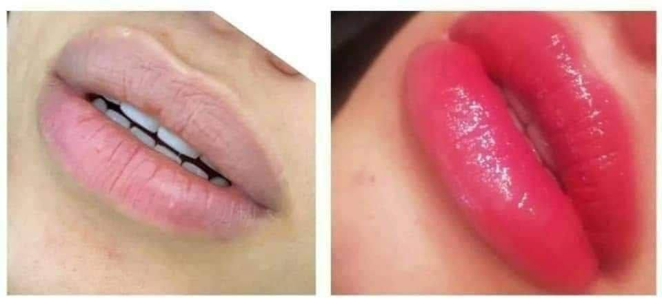 🌸امبولات توريد الشفاه والخدود
🌸Glow BB Lip 
وداعا لمراكز التجميل توريد الشفه بطريقة طبيعية غير جراحية أو مؤلمة
تخلصي من شفاء  بيضاء وحافه و ذات المنظر غيرالمرغوب به💔 
احدث تقنية و غير مؤلمة في تلوين الشفاه والحصول على احمر شفاه شبه دائمي يدوم ٦ اشهر تقريباً 

...تخلصي من المكياج واستقبليلي الصباح بشفاه ورديه 
اكيد كلكم تعرفون هاي الماده شنو تأثيرها ع البشره  من ناحيه التوريد تجنن وطبعا تسوي الخد ابيض على وردي والشفه وردية

السيت يحتوي على ١٢ امبولة
وكل امبولة تكفيج استعمال مرتين الى ٣ مرات 🌸

🌼❤طريقة الاستعمال : ❤🌼
توضع الماده على جميع انحاء البشره تمرر الدرمارولر على جميع انحاء البشره ، يتم تمرير الدرمارولر على المكان الواحد من ٥ الى ٧ مرات او تمرر مرة واحده للديرمابن بعد الانتهاء ، يترك الخد او الشفه لمدة ربع ساعه وبعدها تمسح الماده  المتبقيه على البشره و غسل الوجه بالماء النقي 
يتم تكرار العمليه كل اسبوع مرة واحدة للبشره الحساسه
و مرتان بالاسبوع للبشره الاعتياديه
صنع في كوريا
احذروا التقليد 🚫
🚘 يوجد خدمة توصيل لجميع محافظات العراق 🚘


**إذا كنت صاحب هذا الإعلان وتريد حذفه لأي سبب، رجاءا أرسل رسالة إلى الدعم الفني**