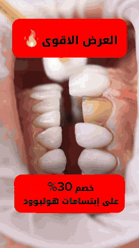 #اقوى_العروض  بمناسبة رأس السنة الميلادية سيكون هناك خصم داخل قسم 🦷 ال...