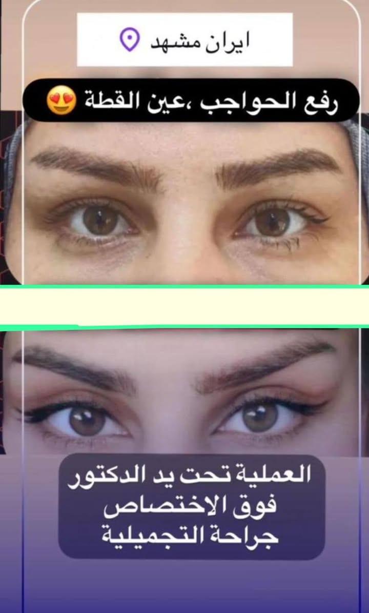 سلام علیکم.
معاکم...  محمد
مترجم طبیه وخبير في  علاج العيون وعمليات التجميل فی مشهد للإجابة عن إستفساراتكم وأسئلتكم أرجو مراسلتي عبرالخاص مع الشكر والتقدير .مع کافه الخدمات الطبیه🙏💐

*********** واتساب
