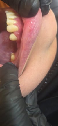 تجميل الأسنان • سن طبيعي • عيادة الرواسي