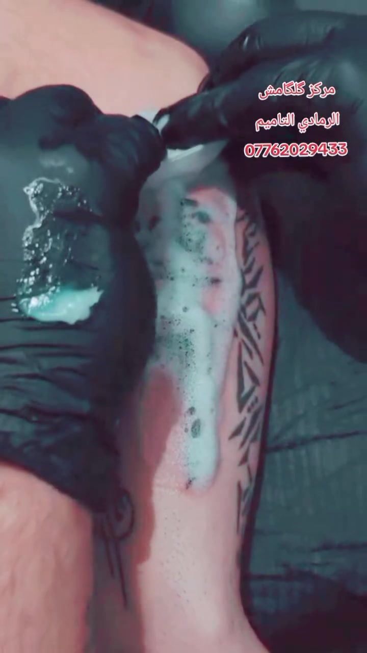 مركز گلگامش للوشم وازالة الوشم 
العنوان الرمادي التاميم 📍 
للاستفسار خاص وبالخدمه 🌹 
*********** اتصال + واتساب
*********** واتساب
*********** اتصال 
#مركز_گلگامش #fyp #وشم #الرمادي #الانبار
