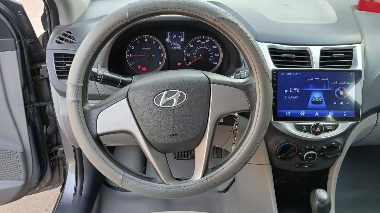 السلام عليكم ؛ للبيع اكسنت موديل ١٦ محرك ١٦٠٠ وارد امريكي حادثها جنطه ومصبوغ بمريكى سياره جاهزه من كلشي اي استفسار اتصل عل رقم ب85وبيها مجال لطيبين  ***********سيظهر النص والصور الذي تقوم بنسخها هنا تلقائياً*********** بكره انا بغداد بوب الشام سياره بيها حادث خلفي
