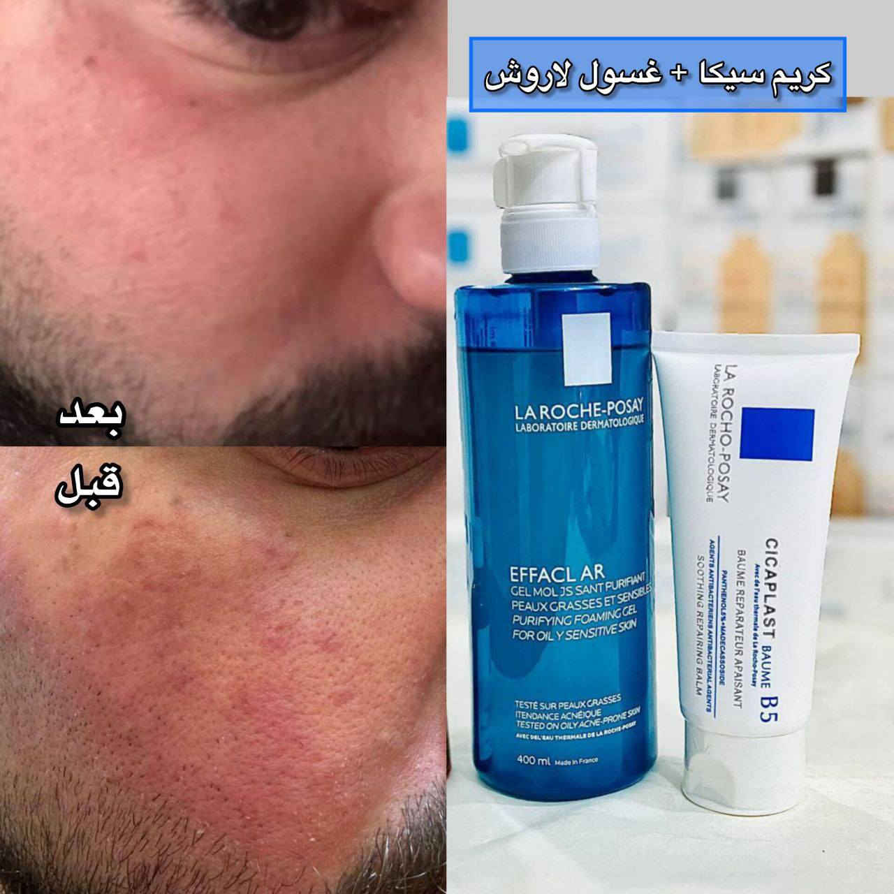 ✨ عـرض هذا الشهـر للبشـرة ✨
من La Roche-Posay 🇫🇷
🧴 غسول + كريم 
مناسب للبشرة الدهنية، الحساسة والمعرضة للحبوب
💙 الغسول (400ml):
ينظف بلطف بدون ما ينشف البشرة
ينظم الدهون ويقلل الحبوب وآثارها
يعطي نضارة ويزيل الزيوت والبكتيريا
💙 الكريم (سيكابلاست B5 - 100ml):
يرمم البشرة ويهدئها
ترطيب عميق + تقليل التهيج والاحمرار

 الـسعر : 20 ألـف فقط 🇮🇶
🚚 التوصيل: بغداد 4 | باقي المحافظات 6


**إذا كنت صاحب هذا الإعلان وتريد حذفه لأي سبب، رجاءا أرسل رسالة إلى الدعم الفني**