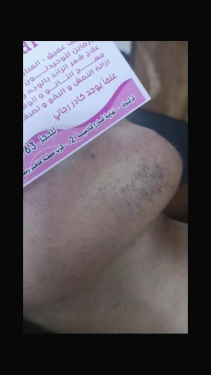 للححز ***********
