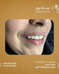 د. كتوره د.زهراء صادق  عيادة روح لطب وتجميل الاسنان