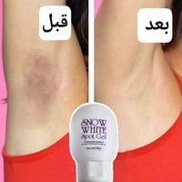 سنو وايت سبوت • مبيض دائمي • مناطق حساسة