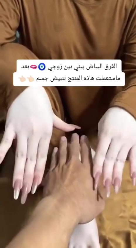 شفتو الفرق بيني وبين زوجي هذا كله بفضل منتج كوتا برايت يخبل انصح كل البنات تجيبه متوفر عدنا للاستفسار خاص


**إذا كنت صاحب هذا الإعلان وتريد حذفه لأي سبب، رجاءا أرسل رسالة إلى الدعم الفني**