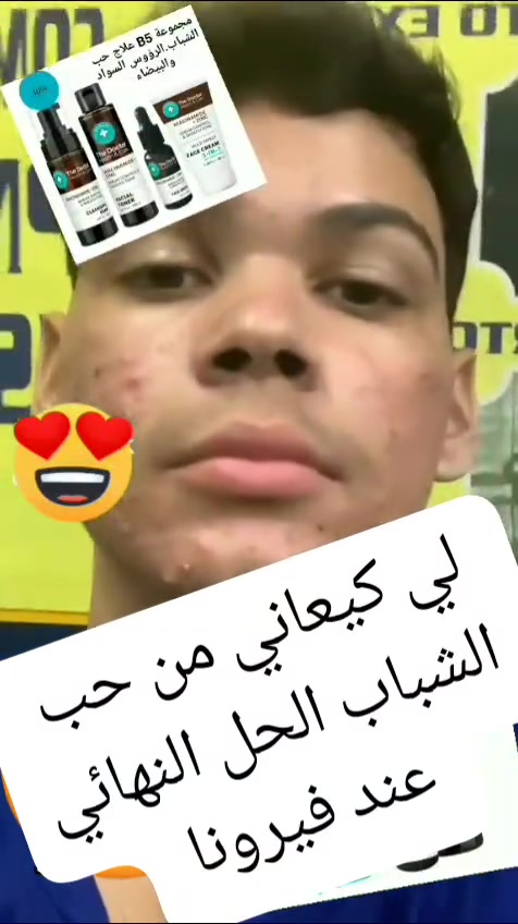 عيلج حب الشباب #فيرونا


**إذا كنت صاحب هذا الإعلان وتريد حذفه لأي سبب، رجاءا أرسل رسالة إلى الدعم الفني**
