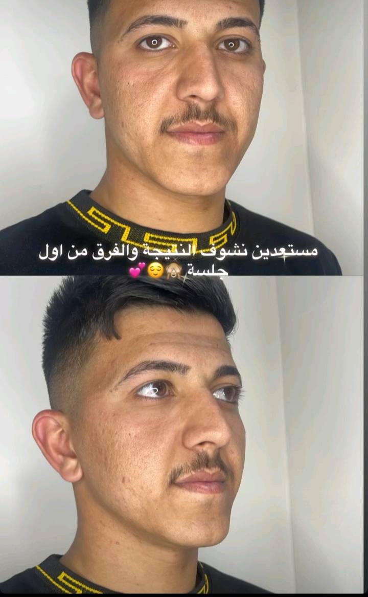 البشره التعبانه يم كاندي بيوتي العلاج
فقط تنظيف البشره  تعالو وتدللون
شنو اسم الخدمة بالضبط اللي تقدموها؟ ترتيب حواجب بس لو وياها تنظيف عميق/تفتيح/شد ملامح؟: 
تنظيف بشره 
وين موقعكم بالضبط بأي مدينة أو منطقة بالعراق؟ وهل أكو توصيل أو حجز أونلاين؟: 
كركوك حي الوسطي قرب محطة الأصدقاء   مركز مينا 
 *********** الرقم كم سعر الخدمة وهل السعر شامل كلشي لو أكو إضافات حسب الحالة؟: 
حسب
شلون يتم الحجز وكم تاخذون وقت للموعد؟ وأكو أوقات أو أيام معينة متوفرين بيها؟: 
الحجز يتم عبر الاتصال وياخذ وقت لموعد كل الأيام 