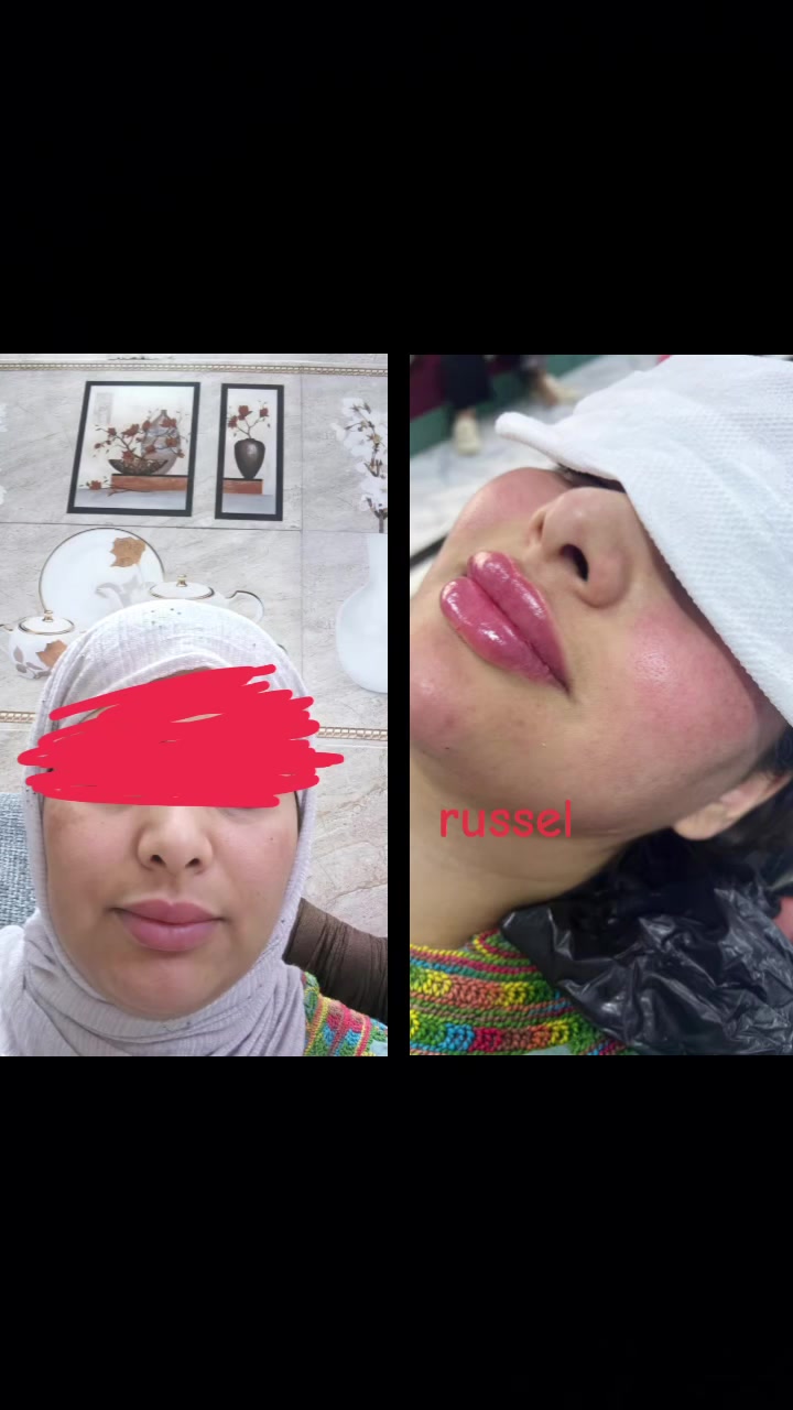 السلام عليكم يشررفنا زيارتكم لصالون russel clinc وعياده الفرع الاول كربلاء حي سلام شارع الكوسترات  نهايته مجاور مكتب المهندس والعياده في حي العباس التواصل واتساب *********** @إشارة
