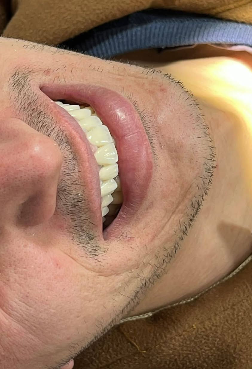 ابتسامة  ساحره وثقة مضاعفه 🩵🔥 عيادتنا فرع حي النصر 🔥🔥

تعويض الاسنان باستخدام (الزاركون  ألالماني) لمراجعنا الاخ محمد العگيلي  من حي النصر 

على يد 🔥
الطبيب الاختصاص
د.يوسف الهدلي 
( ماجستير في طب ومعالجة الاسنان) 

خلي ابتسامتك ويانه احلى 🩵

أبتسامتك ~ يم عيادات الفرح لطب وتجميل الأسنان ~ غير ✨😍

علماً كافة الابتسامات والحشوات مع ضمان مدى الحياة 😎

للإتصال 📞📞 
فرع حي النصر
#العنوان
حي النصر/ شارع الاطباء / قرب جامع الأمام المهدي
فوق صيدلية مصطفى جاسم أو أسواق الزعيم 

للحجز والاستفسار 

*********** ☎️

دوام العياده ⏰
فرع حي النصر 
من الساعه 4  عصرا 
إلى 
الساعه 9 مساءا
