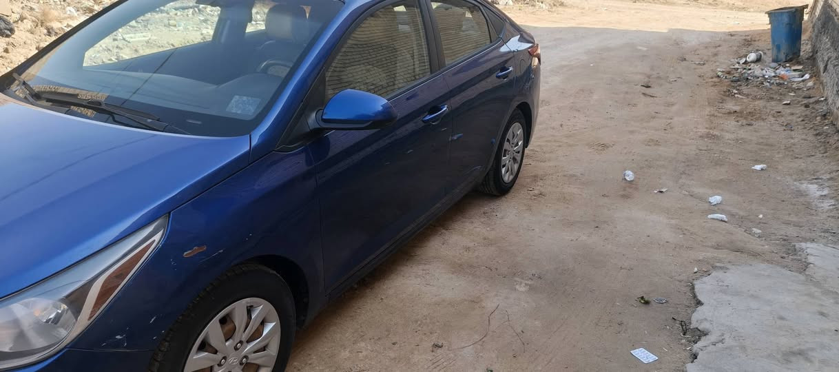 سلام عليكم سياره اكسنت للبيع سياره نضيفه
الاستفسار
***********
