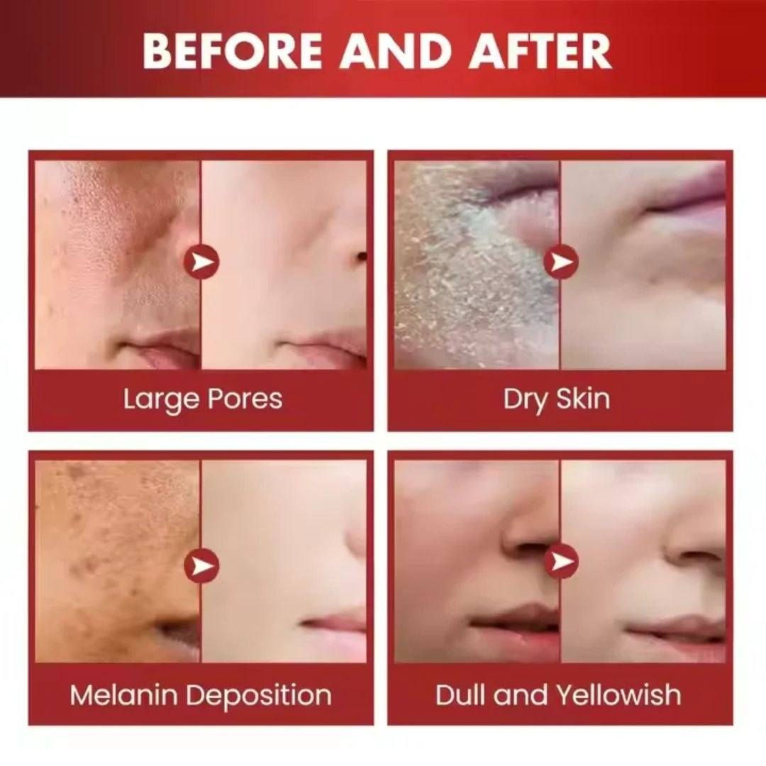 @إشارة 
🌹 كريم دم التين  
 😍لمسة فاخرة لبشرة مشدودة ونضرة
يساعد على تجديد البشرة وتقليل علامات التقدم بالعمر ويمنحك نعومة وإشراقة واضحة 🌸
🌷 الفوائد:
🌼 شد البشرة وتحسين مرونتها
🌼 تقليل التجاعيد والخطوط الدقيقة
🌼 ترطيب عميق وتغذية البشرة
🌼 توحيد لون البشرة ومنحها إشراقة طبيعية
🌿 المكونات:
🍃 دم التين الملكي
🍃 الريتينول
🍃 مستخلص المشيمه
⭐️ التفاصيل:
💗 الحجم: 50 غرام


**إذا كنت صاحب هذا الإعلان وتريد حذفه لأي سبب، رجاءا أرسل رسالة إلى الدعم الفني**