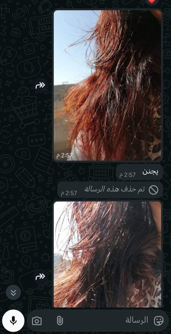 الدنيا احترت، وعطلة، والشعر يحتاج تغذية، وفروة الرأس تريد تتخلص من الحرارة، حتى تتنشط الدورة الدموية وتتقوى بصيلات الشعر، لازم تستخدمون حنة زينة خاتون 👸🏻،،، وجايكم العيد،،  بالنسبة للحنة ممتازة لفروة الرأس الشعر، للمعة وكثافة وطول وشعر صحي خالي من التساقط والتقصف والخشونه والتشابك 😍😍😍  راح تشوفين الفرق من أول استخدام وهذا 👇 جزء من نتائج الزبائن 😎😎


**إذا كنت صاحب هذا الإعلان وتريد حذفه لأي سبب، رجاءا أرسل رسالة إلى الدعم الفني**