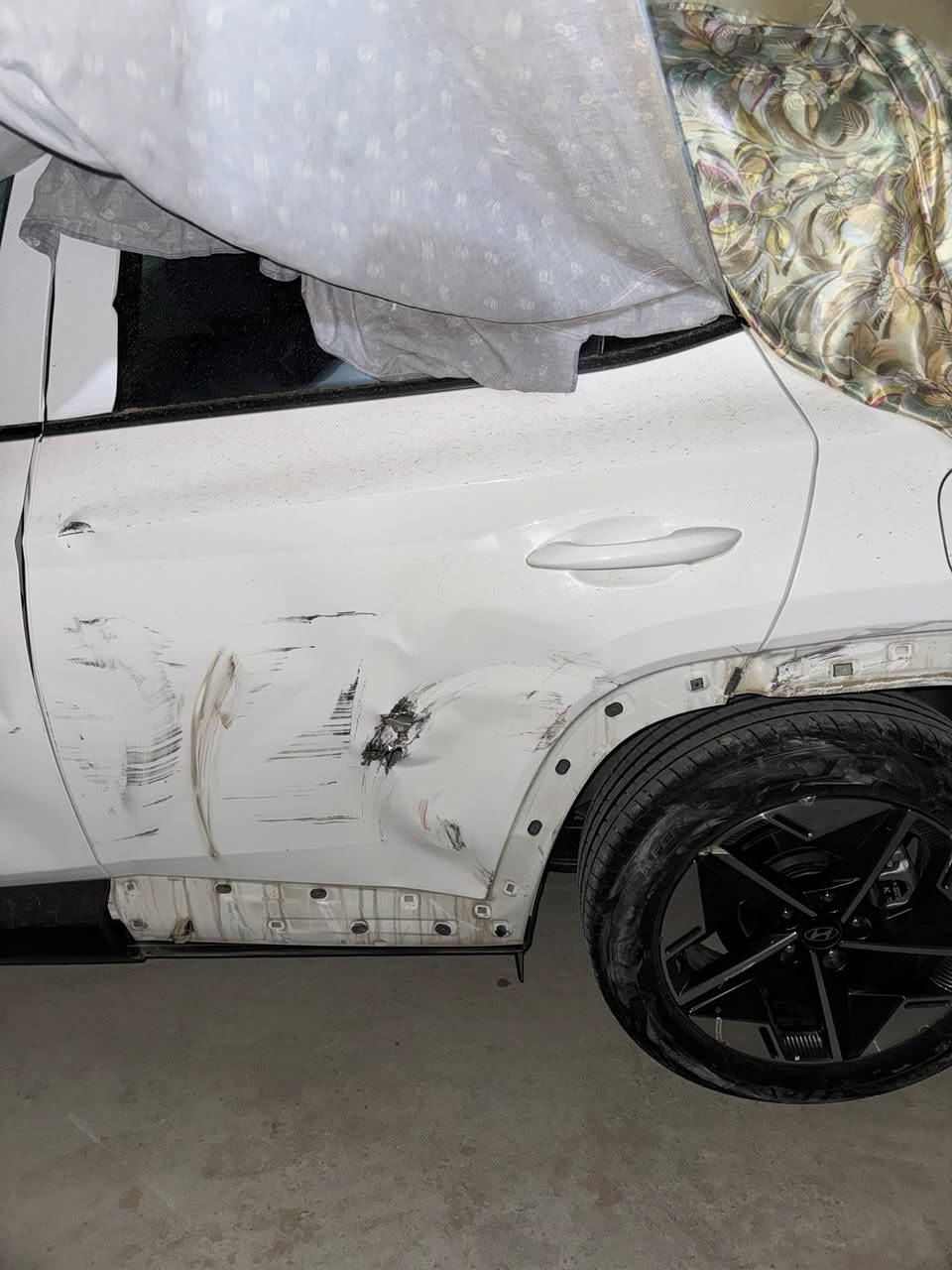 اخوان السلام عليكم 
للبيع فقط توسان ٢٠٢٥ على ايدي السياره صار بيها حادث الله يكفيكم الشر 
ابيع على حادثها 
*********** الشراي يتصل على هذا الرقم وانطي  المواصفات واني خادم 
وهاي صور الحادث
مكان السياره حله/شارع٦٠
