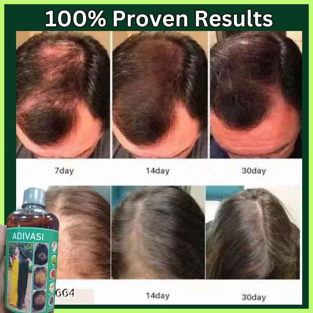 108 عشبة هندية.. يعني الحل الجذري لكل مشاكل الشعر! 🇮🇳✨
ليش زيت Adivasi مختلف عن أي زيت ثاني بالسوق؟
لأن تركيبته فريدة وتتكون من 108 عشبة طبيعية صافية! 🍃
يعني دتنطين شعرج فيتامينات ومعادن وعلاجات مكثفة بلمسة وحدة.
✅ يعالج الصلع الوراثي والتساقط الكربي.
✅ يثخن الشعرة ويمنع تكسرها.
✅ يطول الشعر بفترة قياسية.
✅ يرجع الحيوية للشعر التالف والمحروق.
دللي شعرج بخلاصة الطبيعة.. 💆‍♀️

صنع في الهند النجف, العراق


**إذا كنت صاحب هذا الإعلان وتريد حذفه لأي سبب، رجاءا أرسل رسالة إلى الدعم الفني**