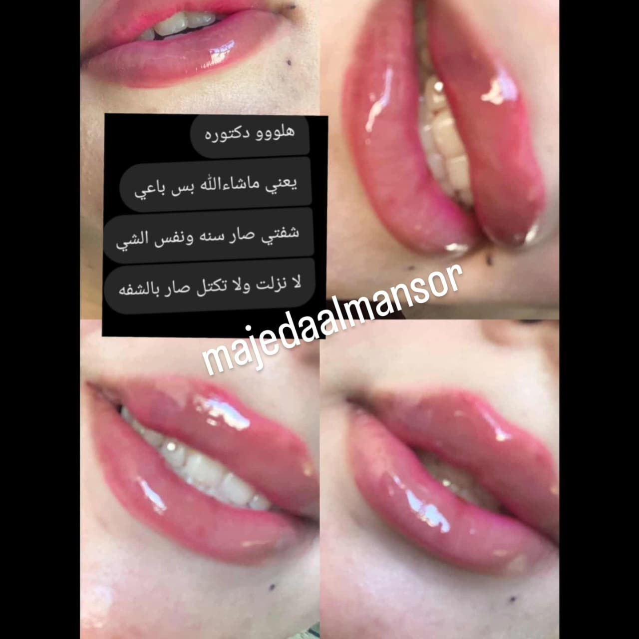 استغلي عروض العيد  وتعالي زيدي انوثتج وجمالج اجمل رسمات الشفاه ❤️
 ع يد خبيرة التجميل والمدربة الدولية
 الدكتورة ماجدة المنصور Jojo Alnabeel 
العنوان بغداد الحسينية مقابل السوق الكبير مجاور مرطبات العذراء
مجمع سما الحسينيه للطابق الثاني قسم التجميل والصالون ***********
