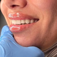 طويريج • عيادة اسنان • تقويم اسنان