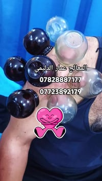 # حجامه عامه علاج طبيعي انزلاق تشنجات علق طبي ابر صيني مساج علاجي مساج...