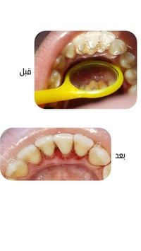 طب اسنان • خصم 30% • الجولان
