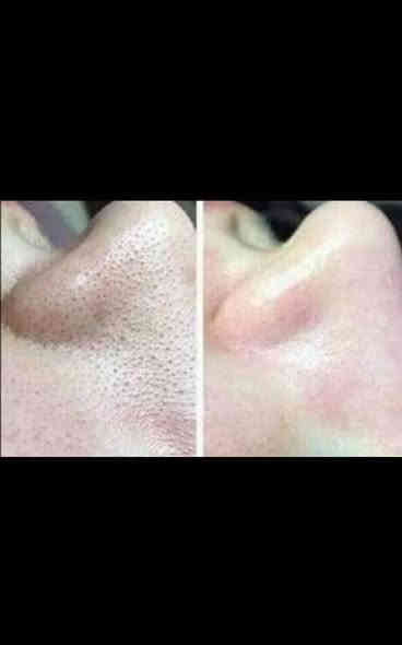 صباح الخير بنات عروض شهر ل١٢ لحد رأس السنة الميلاديه
💐💐💐💐🏵️🏵️🏵️🏵️🏵️

نبدي بالصلاه على رسولنا الكريم محمد صل الله عليه وآل وسلم وعلى آل بيت محمد 🤲

🧑‍🎄🧑‍🎄🧑‍🎄🧑‍🎄🧑‍🎄
1_ حف الوجه خيط 10 الف + هديه قناع النضاره للبشره 🤗
🧑‍🎄🧑‍🎄🧑‍🎄🧑‍🎄

2_ حف الوجه شمع وخيط 10 الف + قناع النضاره هديه 😍
🧑‍🎄🧑‍🎄🧑‍🎄🧑‍🎄🧑‍🎄

3_ حف الوجه شمع وخيط مع رقبه وجه وكفه هههههه 15 الف + هديه قناع النضاره البشره 🥰
🧑‍🎄🧑‍🎄🧑‍🎄🧑‍🎄

4_ قص الكذله مجانا 😘
🧑‍🎄🧑‍🎄🧑‍🎄🧑‍🎄

5_ غسل الشعر مع القص 10 الف

6_ تنظيف بشره عميق لازاله جلد ميت ورؤس سوداء ب15 الف 

7_ صبغ جذور الشعر 15 الف + قص أو تعديل الشعر هديه 🙋
🧑‍🎄🧑‍🎄🧑‍🎄🧑‍🎄

8_ صبغ شعر قصير للرقبه 25 الف+ ماسك معالج قص أو تعديل الشعر + شيسوار 🙆
🧑‍🎄🧑‍🎄🧑‍🎄🧑‍🎄

9_ صبغ الشعر للكتف 30 الف+ ماسك مع قص أو تعديل الشعر+ شيسوار💁
🧑‍🎄🧑‍🎄🧑‍🎄🧑‍🎄

12_ مع كل جلسه بروتين معالج مسرح هديه  قص الشعر  + قناع النضاره 🧏
🧑‍🎄🧑‍🎄🧑‍🎄🧑‍🎄

13_ تخصيل شعر قصير للرقبه 25 الف+ ماسك للشعر هديه 🧑
🧑‍🎄🧑‍🎄🧑‍🎄🧑‍🎄

15_ بديكير تنظيف القدم وازاله الجلد ميت 10الف 
 🦶🦶🦶🦶👋👋

16_ واكس الجسم كامل 40 الف مع منطقه البكيني 🌲🌲🌲🌲☃️☃️⛄🎄🎄🎍🎍

للحجز والاستفسار الاتصال على  واتساب 

*********** 

الي تحب تحجز تتواصل ويايه وادزلها موقع مالتي وربي يرزق الجميع يارب العالمين 

🎄🎄🎄🎄🎄🎄🎄🎄⛄⛄⛄⛄⛄⛄
