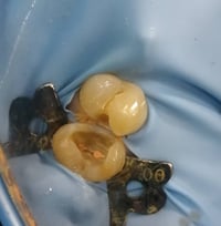 د مهند الطحان • ماجستير تعويض أسنان • صيدلية عبدالله المعماري