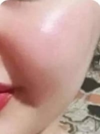 خلطه للبشره • نظاره • خلال اسبوع