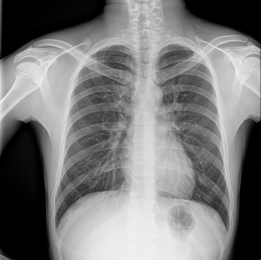 🏥✨ مكتب الجوهرة للأجهزة الطبية ✨🏥

📢 متوفر لدينا الآن

🔹 مستقبل الأشعة الرقمي (DR Detector)
🔹 نوع SHOW IMAGE
🔹 أجهزة جديدة بالكامل (غير مستعملة)

⭐ المواصفات والمزايا:
✅ Wireless – اتصال لاسلكي كامل
✅ AED (Automatic Exposure Detection) – الكشف التلقائي عن التعريض
✅ مقاس 17 × 17 إنش
✅ مقاوم للماء والغبار بمعيار IP65
✅ سرعة عالية في نقل واستقبال الصور
✅ جودة تصوير استثنائية ودقة تشخيصية عالية
✅ متوافق مع مختلف أنظمة الأشعة الرقمية

🏅 شهادات الجودة العالمية:
✔ FDA Certification
✔ CE Certification
✔ ISO Certification

📦 المحتويات:
• Flat Panel Detector
• Access Point
• Adapter + Charger + بطارية اضافية
• جميع الكيبلات والملحقات الأصلية
• برنامج تشغيل متكامل

🛡 ضمان حقيقي لمدة 3 سنوات
🚚 الشحن والتركيب والتدريب متوفر
🛠 دعم فني وخدمة ما بعد البيع

📞 للتواصل والاستفسار:
0770 285 5535

0770 347 4472

0771 172 9698

📍 مكتب الجوهرة للأجهزة الطبية
ثقتكم مصدر نجاحنا

