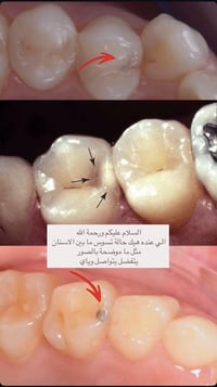 على هذا الرقم تواصلو وياي ٠٧٨٧٦١١٦٠٢٩