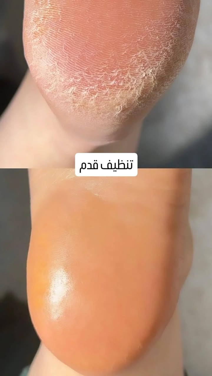 شارع السايد الواحد ***********
