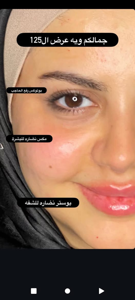 عنواننا النجف ركن السلام جامعه(الاربع شوارع) مجاور ازبري قرب يو كافيه
https://www.instagram.com/reel/DVoo2aKjQVT/?igsh=Mzd2cjQydXVzMXRiللحجز ***********
