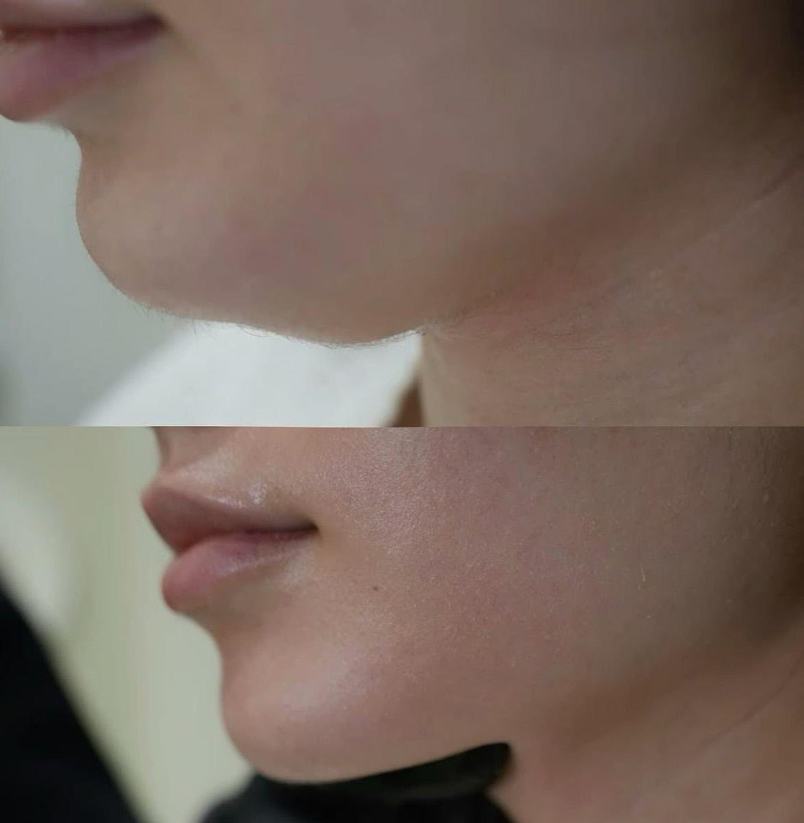 العنوان حي القاهرة مقابل ماركت الباشا
@الرقم ***********

الحجز والاستفسار
