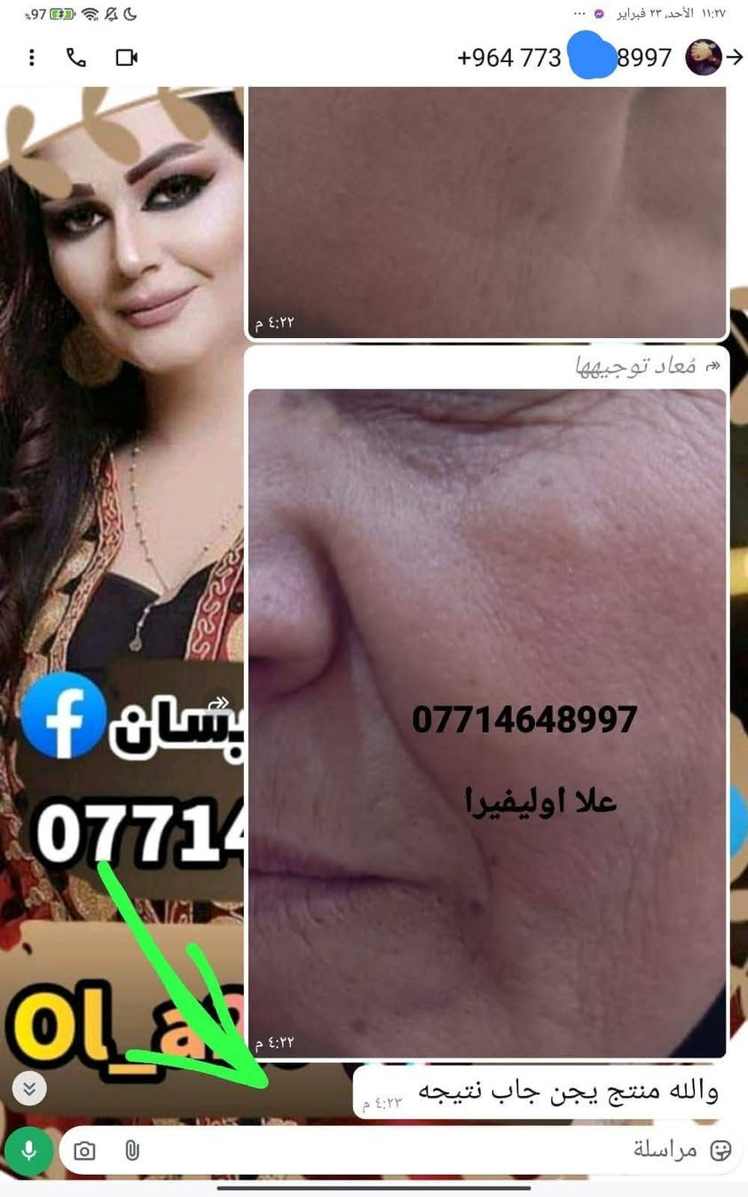 🙏انتبااااااااااه 🙏  الحجز فقط (وتساااااب ) علا اوليفيرا  ***********77
الي يعانوون من جميع مشاكل البشره مع منتجاتنا الطبيعيه  تمتعي ببياض الثلج 😍
 معالج الفااوربتين و السيراميد والعنبر وسيروم الباكشويل وسيىوم النضاره بكج متكامل 
تفتح البشرة 7 درجات والنتيجة دائمية 👌 وهذي تجارب زبائني تشهد 
خدمه توصيل لجميع محافضات
