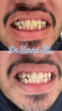 مو كل شي يحتاج وقت طويل… بجلسة وحدة تگدر ترجع ثقتك بابتسامتك 😌  حشوات ...