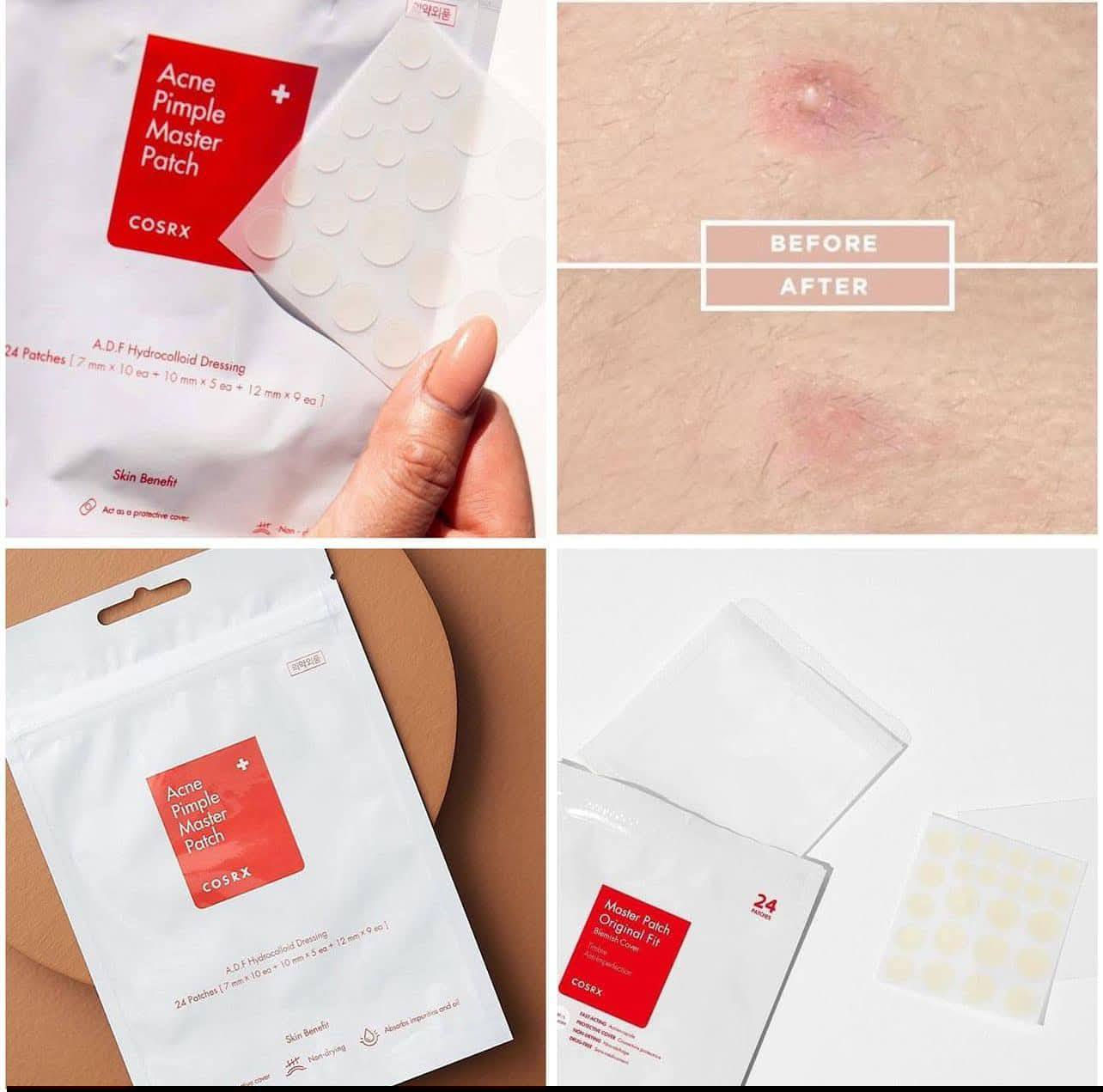 🔴لصقات موضعية من كوزركس معالجة للحبوب 🔴

🔴 COSRX Acne Pimple Master Patch 🔴    

لصقات معالجة الحبوب ماركة cosrx الكورية 🇰🇷

لصقات طبية بأحجام مختلفة ونفس لون البشرة لتضميد وعلاج حب الشباب

 الحل الوحيد للحبوب التي تظهر فجأة والحبوب العنيدة.

تحمي البشرة من التهيج🧏‍♀️ 

وتخفي حب الشباب و بنفس الوقت تعالجه

مناسبه جداً للحبوب التي تظهر بأوقات مفاجأه وخصوصاً للأشخاص الذين لديهم مناسبة.

مكياجات قمر  
جبله بجانب البريد قبل الكنافه الجبلاويه


**إذا كنت صاحب هذا الإعلان وتريد حذفه لأي سبب، رجاءا أرسل رسالة إلى الدعم الفني**