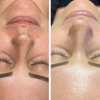 تنفيف بشرة • صبغ حاجب • عروض رمضان