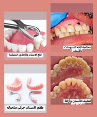 العلاج مجاني • تنظيف أسنان • كلية الحسين كربلاء