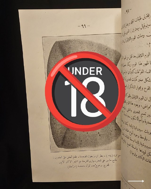 "مرجع طبي تراثي نادر في علم الأمراض السريرية والعلاجات الكلاسيكية!"
🌍
📜
🩺
🩸
📘
(كتاب الأمراض التناسلية وعلاجها وطرق الوقاية منها)
تأليف: الدكتور فخري (طبيب الجلد والأمراض التناسلية).
⚜️
📚
ناشر الطبعة: المطبعة العصرية ومكتبة الخليل لصاحبها خليل الخليلي - مصر
🇪🇬
.
✨
عن هذه النسخة التراثية:
سنة الطبع: 1960-1970
الحالة: ممتازة
✅
الموضوع:
كتاب طبي تاريخي وتخصصي رصين يستعرض بدقة علمية كلاسيكية منظومة الأمراض التناسلية والجلدية الشائعة وطرق تشخيصها السريري وعلاجاتها الدوائية والوقائية المعتمدة في القرن الماضي، يهم جداً أطباء الجلدية والتناسلية، طلاب كليات الطب والصيدلة، الباحثين في تاريخ العلوم الطبية، وهواة اقتناء المخطوطات والمراجع الطبية التراثية النادرة.
للحجز
🔻
:
البوت:
@PH_900bot
أو واتساب: ***********
