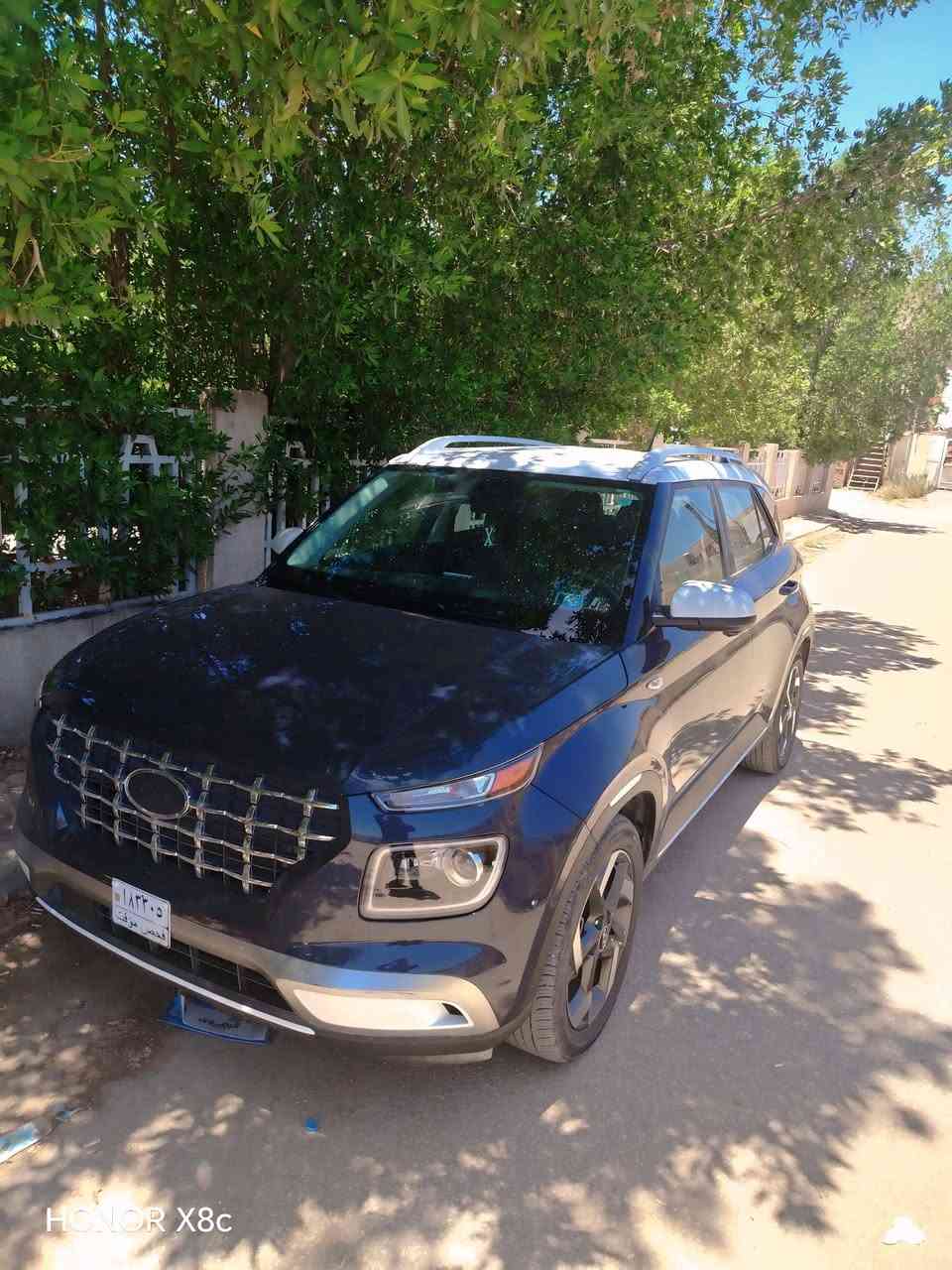 آللهم صلِ على محمد والِ محمد 

هونداي فينو 2024 فول مواصفات دخول جديد حادث البنيد فقط فقط بدون تبديل صور الحادث مرفقه بالمنشور ماشية 2 الف بعدها زيرو 
 بدون رقم دخول جديد تترقم جميع المحافظات 

المواصفات …
-بصمه ابواب وتشغيل  
-رادار امامي وجانبي 
-تشغيل عن بعد
-اشاير بالجاملغ
-ويل كب 
-تحكم ستيرن جهتين
-مثبت سرعه
-تحديد مسار
-شاشه كبيره اندرويد اوتو + كاربلي
-منافذ يو اس بي + تايب سي
-تبريد شاشه
-درايف مود ماوس ثلاث وضعيات 
-عدادات شاشه دجتل
_شحن لاسلكي 

مكان السياره بابل
مستعجل على البيع عندي بناء واريد ابيع 

للاستفسار: 
***********
***********
