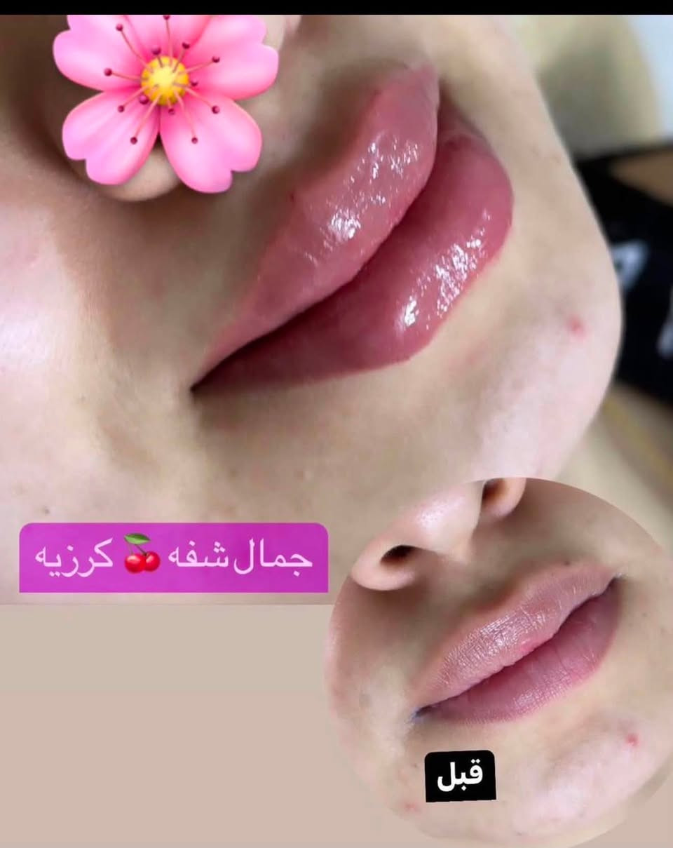 للحجز والاستفسار ***********
