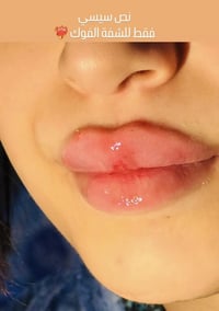 الفلر ورسمتنا الحلوة المراجعه فرحانه بالنتيجه اكيد شغل دكتورة سارة 😻😻 ...