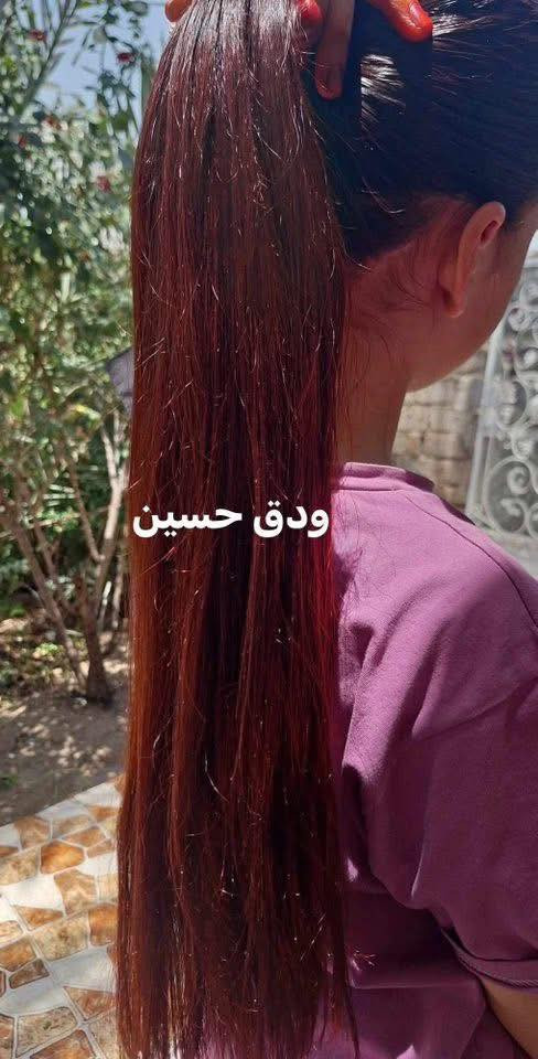 تدرون هذا الجمال كله المن ؟🤔 
هذا جمال #الحنه اليمنية 😍
اليمنية وبس والباقي خس 😂


**إذا كنت صاحب هذا الإعلان وتريد حذفه لأي سبب، رجاءا أرسل رسالة إلى الدعم الفني**