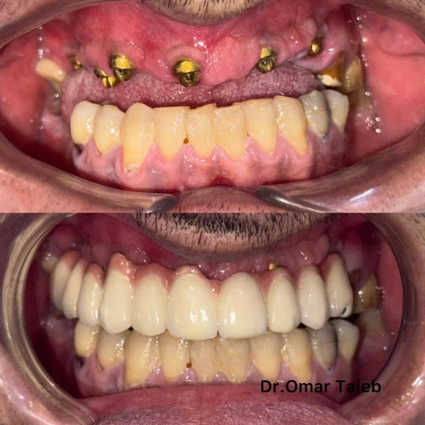 عيادة الدكتور عمر طالب    ( الاول ع بغداد )
طب وجراحة الاسنان 
الطارمية  شارع البعث  داخل الفرع خلف أسواق عسل 
رقم العيادة / ***********   
ملاحظة   يكون الحجز قبل يوم  يبداء من الساعة ١١ صباحا
