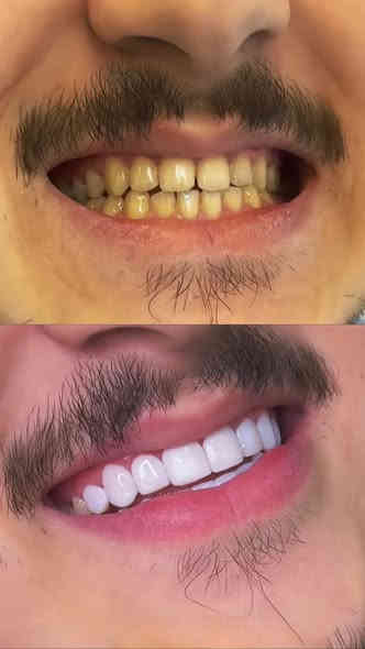 عروض خاصه على قسم الأسنان والتجميل لمدة اسبوع كامل😍
للحجز والاستفسار عبر الخاص او الواتس اب ‭٠٧٧٣ ٣٧٢ ٩٣٠٩‬
