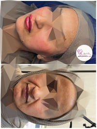 عيادة تجميل • مجمع الكندي • ليزر وهايڤو