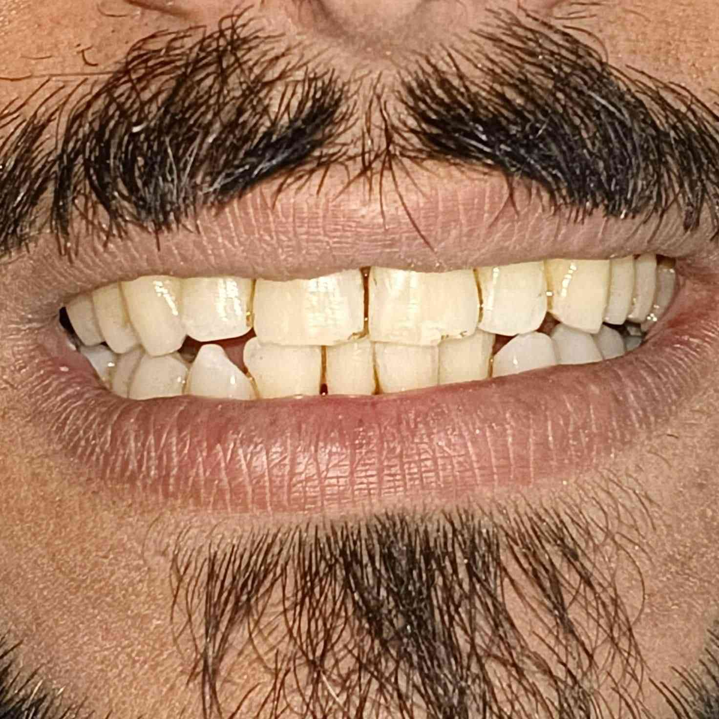 حي البساتين قرب مرطبات كريم سفيح
الدكتور حاتم مالك فوك المظمد السيد جابر *********** وهذا رقمي العياده @الجميع
